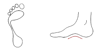 A foot with a high arch is often too rigid and inflexible, which increases the likelihood of supination during walking & running. This results in poor shock absorption, much of which can transmit up the kinetic chain into the leg, hip & back.